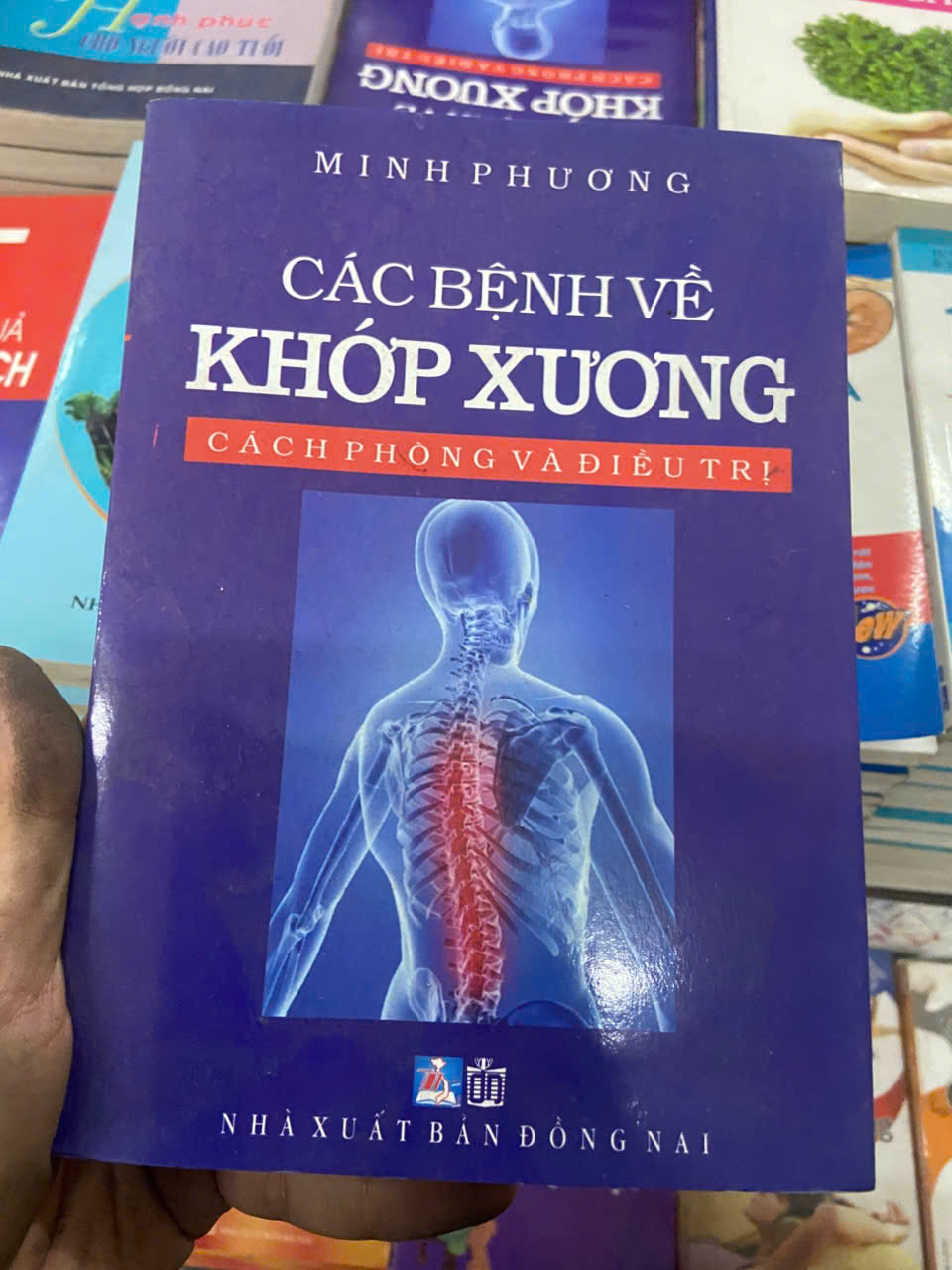 Các bệnh về khớp xương - Minh Phương (Sách Y học - Sức khỏe - Thể thao) VAVO