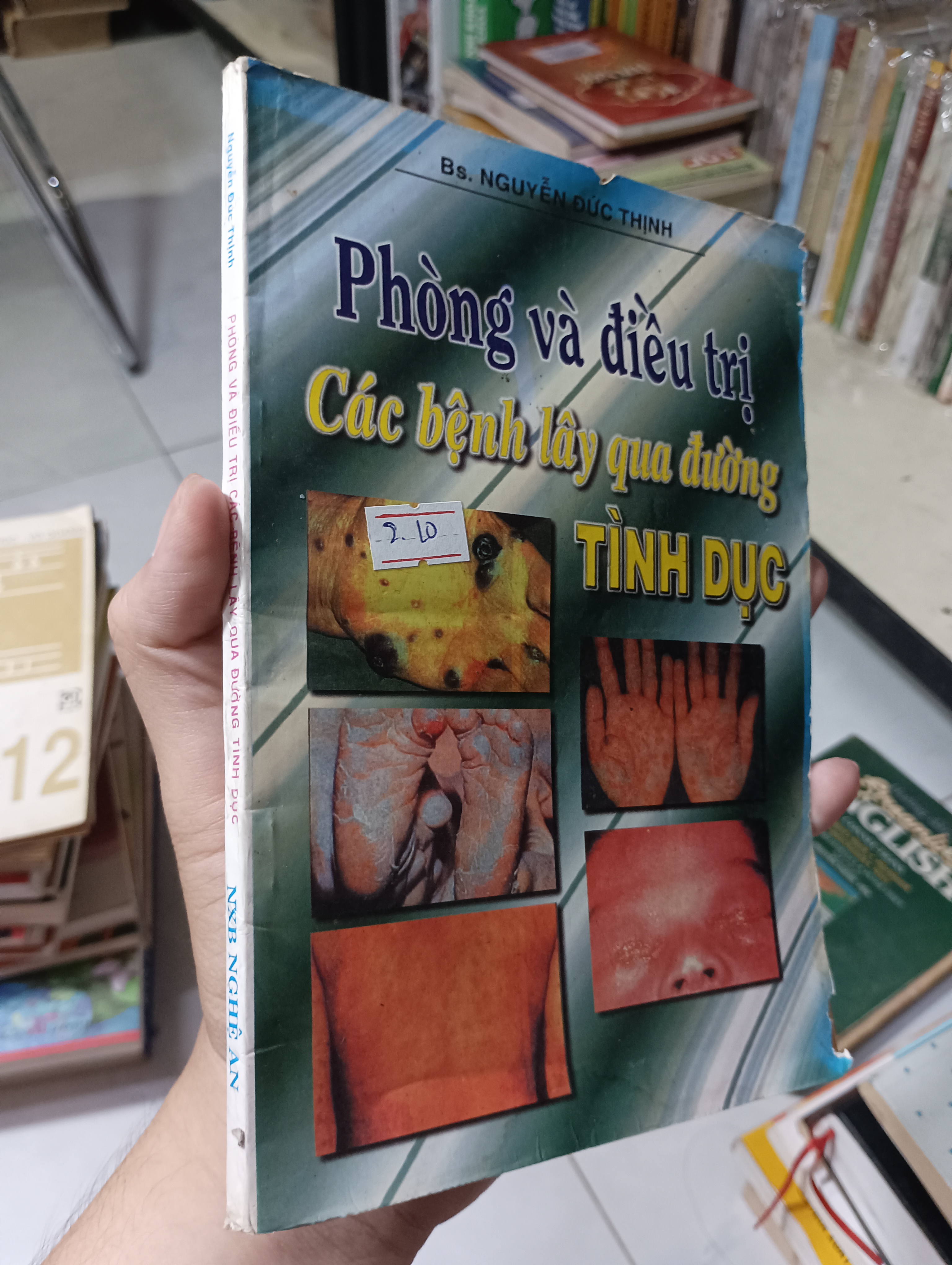 Phòng Và Điều Trị Các Bệnh Lây Qua Đường Tình Dục - Bs. Nguyễn Đức Thịnh 1997 70% ố (Sách Y học - Sức khỏe - Thể thao) HCM