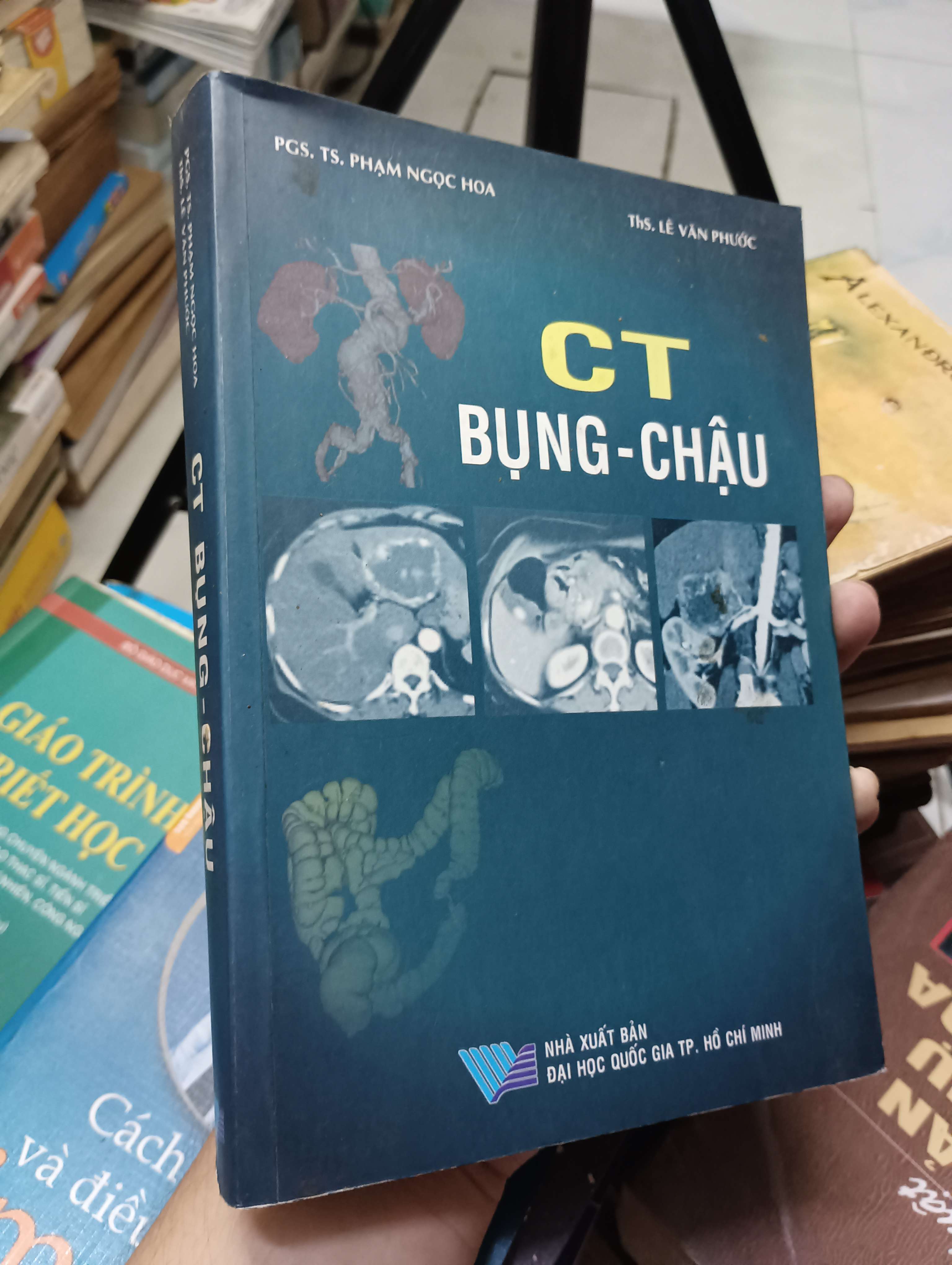 CT Bụng - Chậu (PGS. TS. Phạm Ngọc Hoa & ThS. Lê Văn Phước) 2009 80% (Sách Y học - Sức khỏe - Thể thao) HLSC