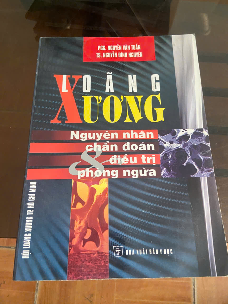 Loãng xương nguyên nhân chẩn đoán & điều trị phòng ngừa - Nguyễn Văn Tuấn Mới 80% (Sách Y học - Sức khỏe - Thể thao) VAVO