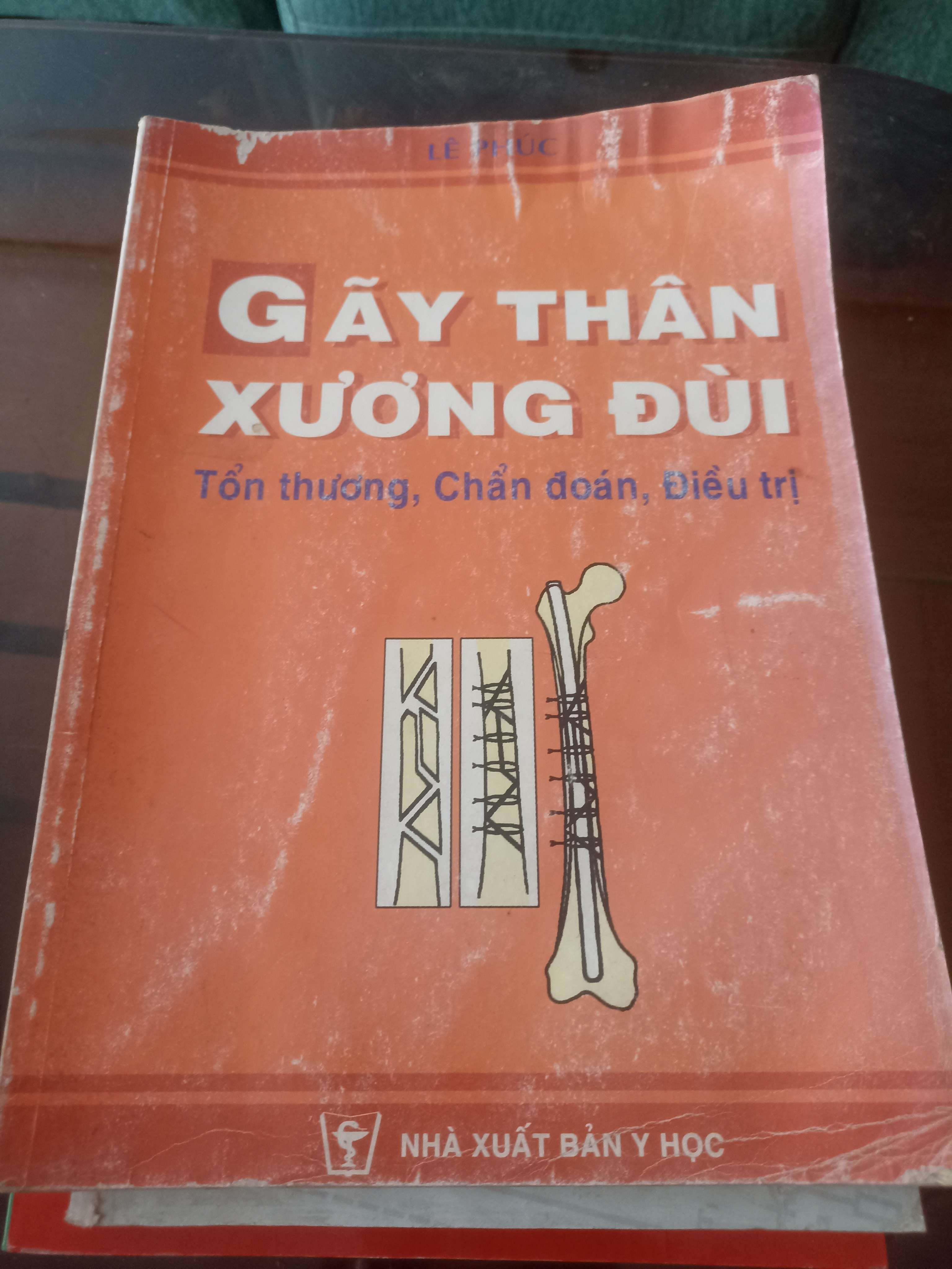 Gãy thân xương đùi: Tổn thương, chẩn đoán, điều trị Mới 80% (Sách giáo khoa - giáo trình) VAVO