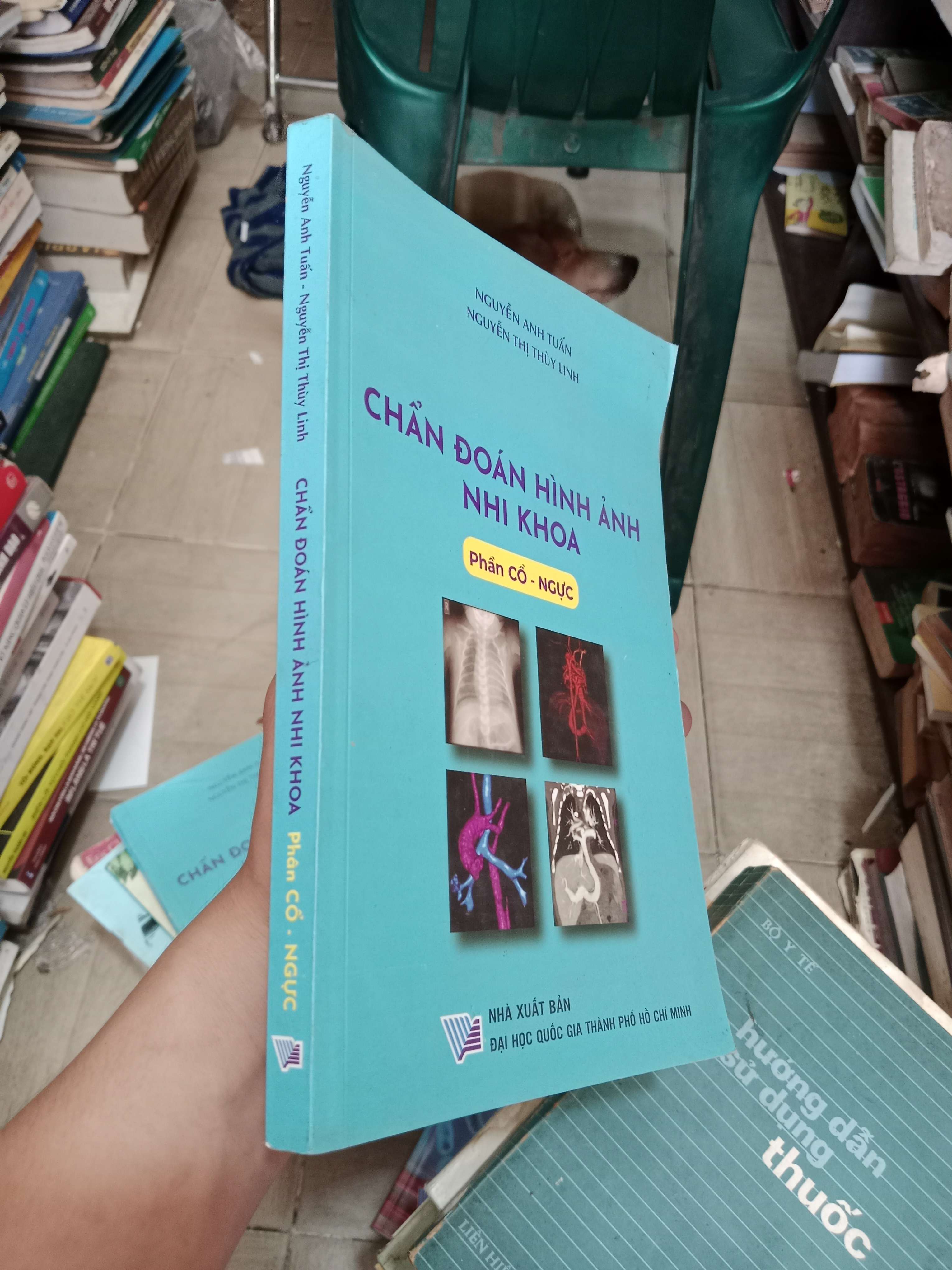 Chẩn đoán hình ảnh nhi khoa - Phần Cổ - Ngực - Nguyễn Anh Tuấn, Nguyễn Thị Thúy Linh 2022 Mới 80% (Sách Y học - Sức khỏe - Thể thao) OKB-K4T2
