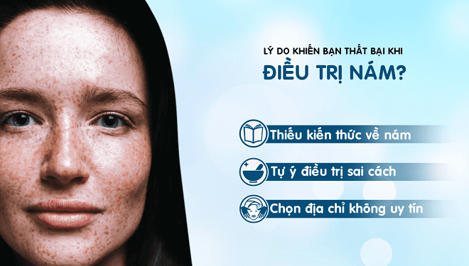 Tự hủy hoại da vì trị nám sai cách chị em nên chú ý