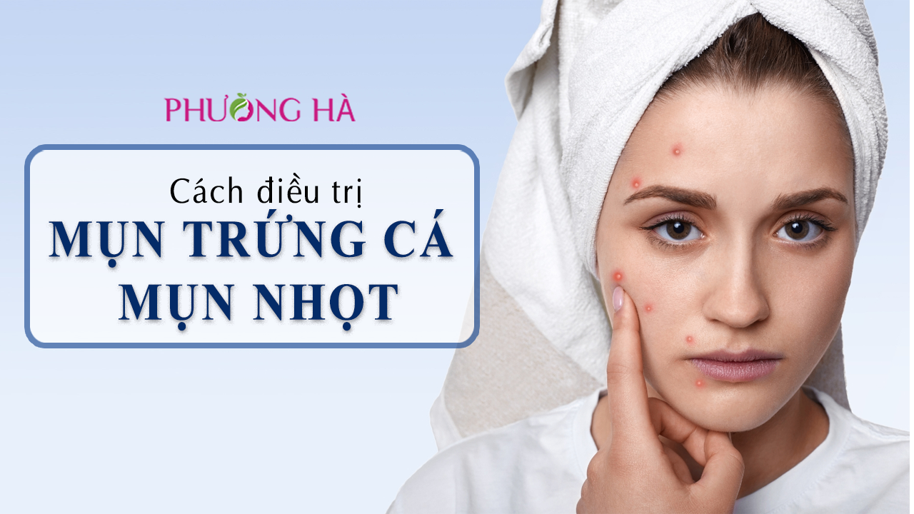 Mụn Trứng Cá Và Mụn Nhọt: Sự Khác Nhau Và Cách Điều Trị Mụn Hiệu Quả