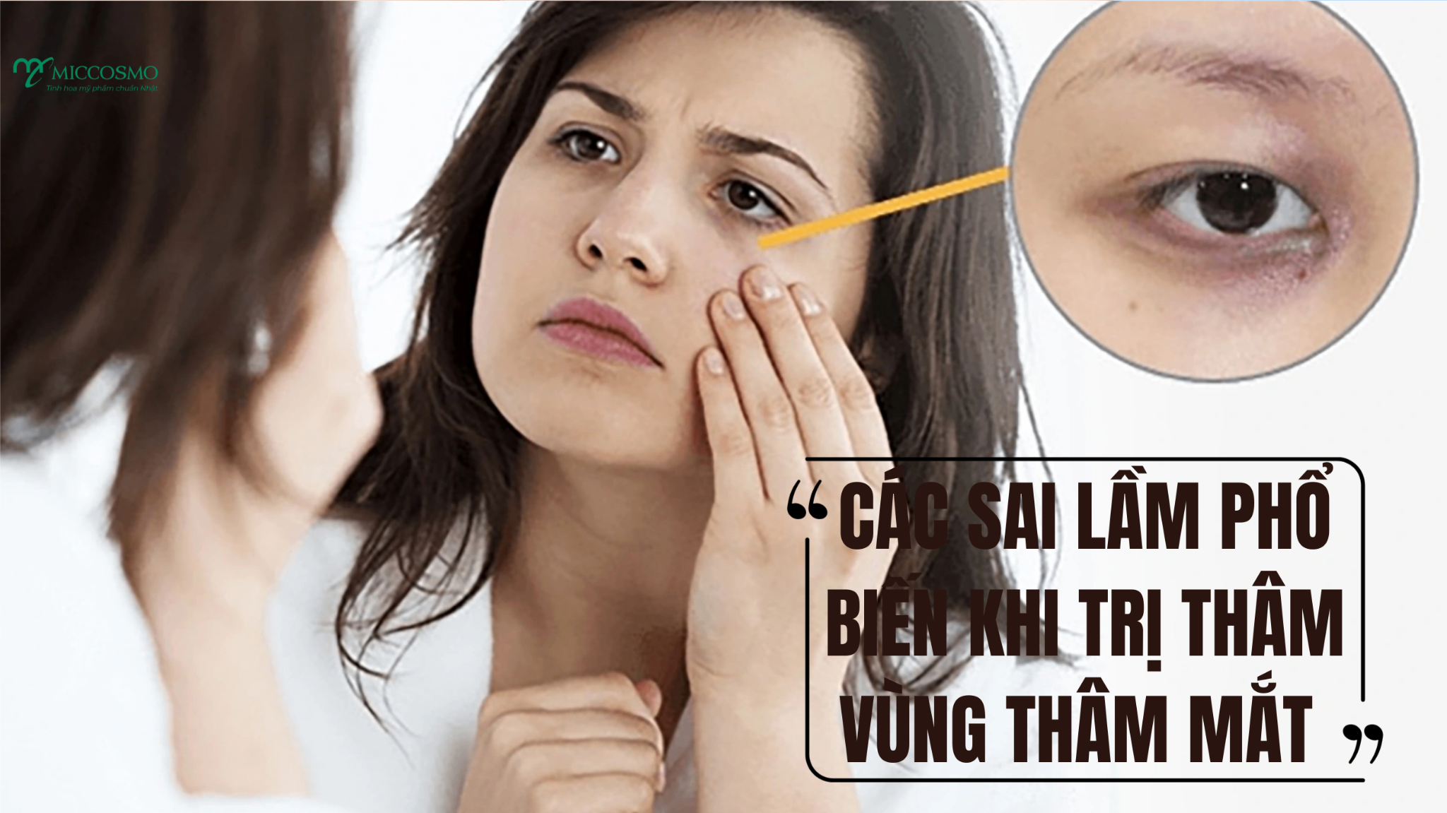 7-meo-lam-mo-tham-mat-lau-nam-vinh-vien-hieu-qua-nhat-bac-si-da-lieu-khuyen-ap-dung-_blob-3.png