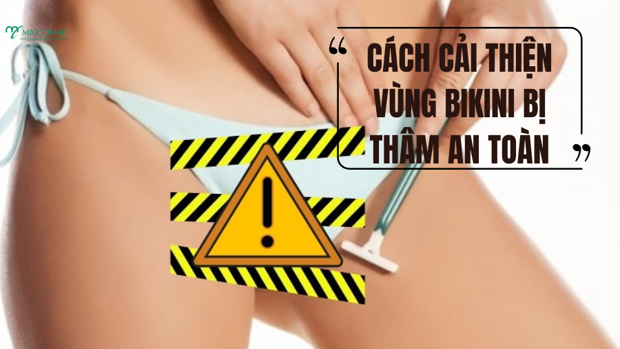 9-ly-do-khien-vung-bikini-bi-tham-va-cach-cai-thien-an-toan-khong-kich-ung_Cach-cai-thien-vung-bikini-bi-tham-an-toan.png