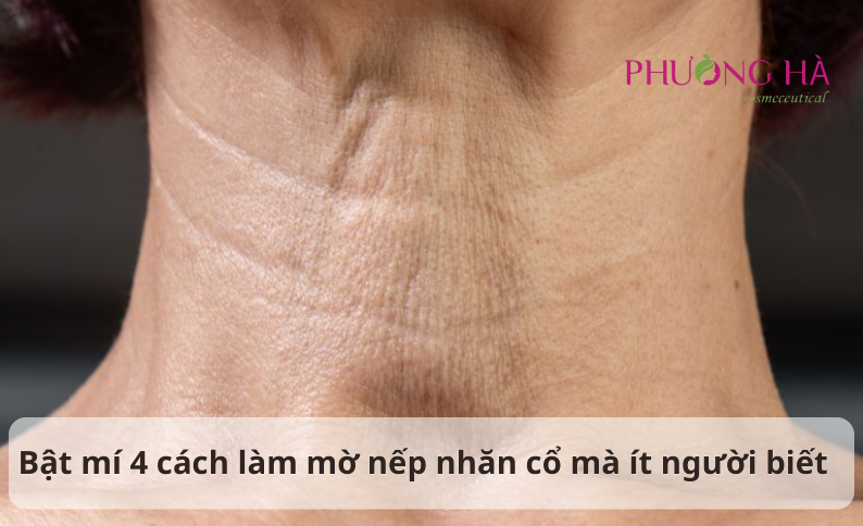 Bật mí 4 cách làm mờ nếp nhăn cổ mà ít người biết