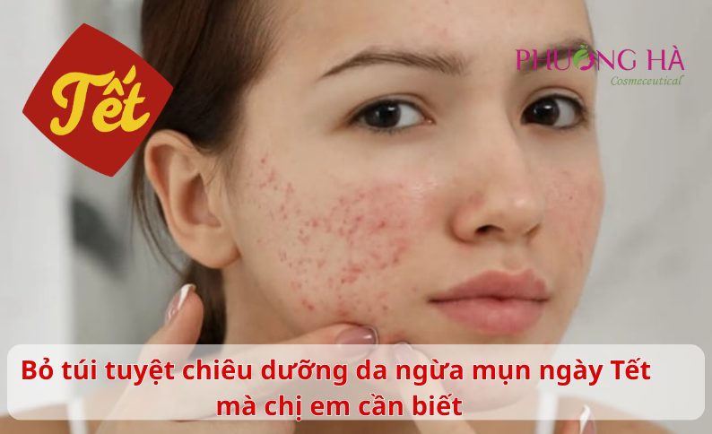 Bỏ túi tuyệt chiêu dưỡng da ngừa mụn ngày Tết mà chị em cần biết