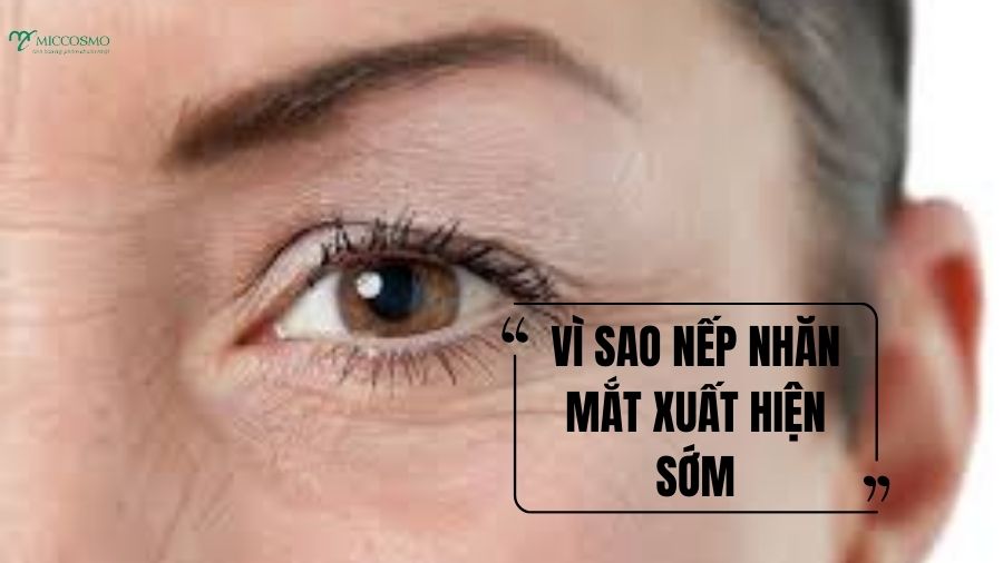 Chia sẻ 6 thói quen giúp hạn chế nếp nhăn vùng mắt mỗi ngày