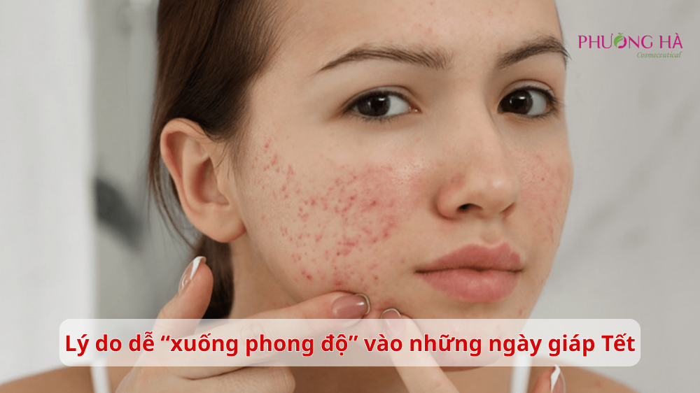 Chia-se-nhung-luu-y-duong-da-ngay-giap-Tet-de-da-luon-cang-muot-khoe-dep-1.png
