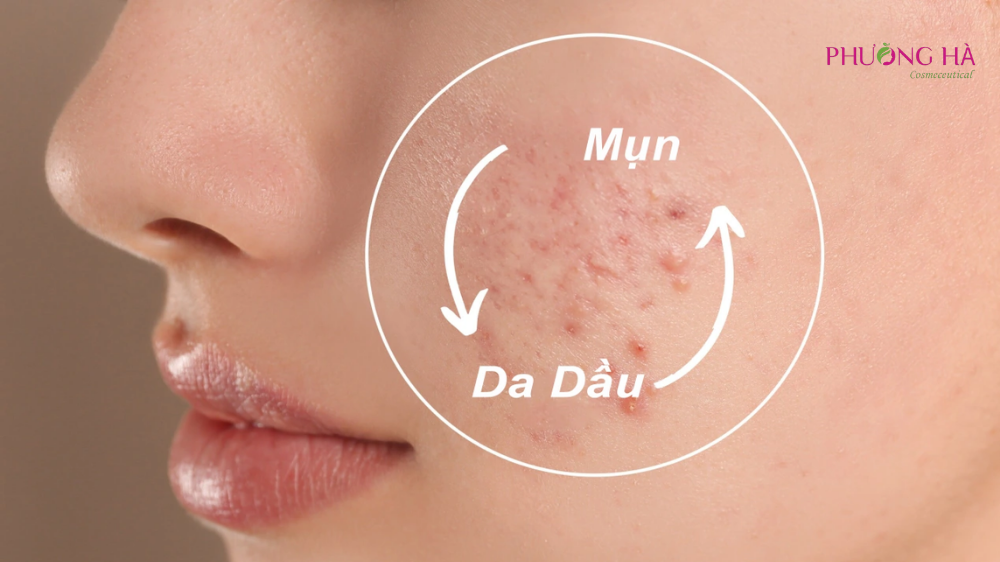 Da-dau-co-can-duong-am-khong-Giai-dap-va-cach-duong-dung-3.png