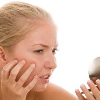 Loại bỏ sẹo mụn trứng cá theo cách của chuyên gia