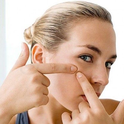 Nặn mụn có tốt không? Lời tự thú của một tín đồ nặn mụn
