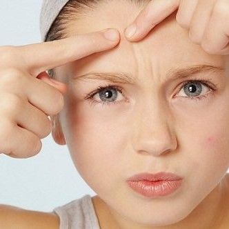Nguyên nhân gây ra mụn trứng cá?