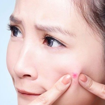 Các cách trị mụn phổ biến triệt để và giảm thiểu thâm sẹo
