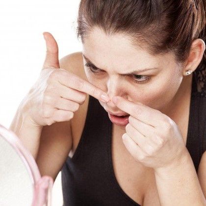 Hướng dẫn loại bỏ mụn đầu đen triệt để và đúng cách không làm giãn nở lỗ chân lông