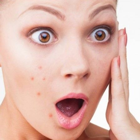 Chia sẻ kinh nghiệm chăm sóc da, xử lý và điều trị mụn