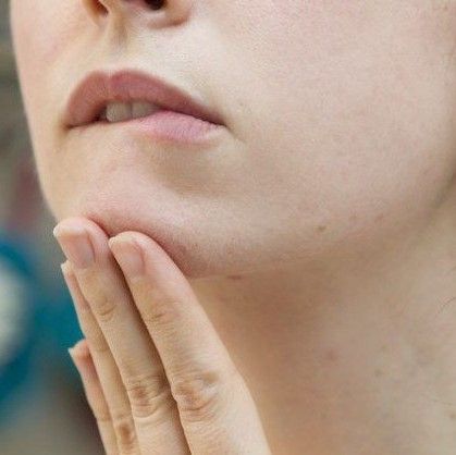 8 mẹo giúp ngăn ngừa và điều trị mụn nội tiết tố