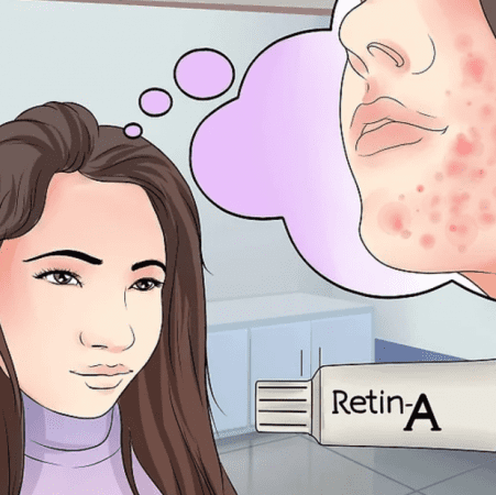 So sánh hai siêu phẩm trị mụn từ Paula’s Choice và Vivantskincare