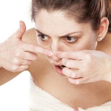 Mụn nổi ở vùng tam giác trên mặt có gây nguy hiểm tính mạng