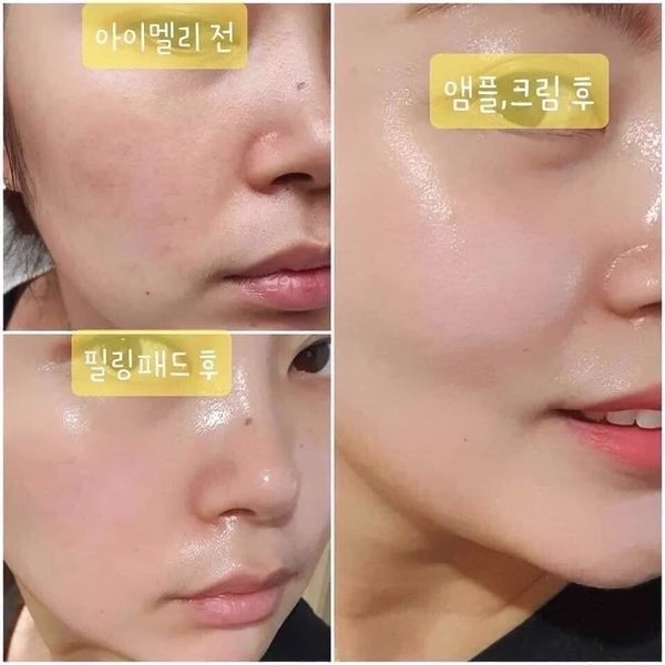 Viên Collagen tươi JM Collagen Multi Vita Capsule Ampoule