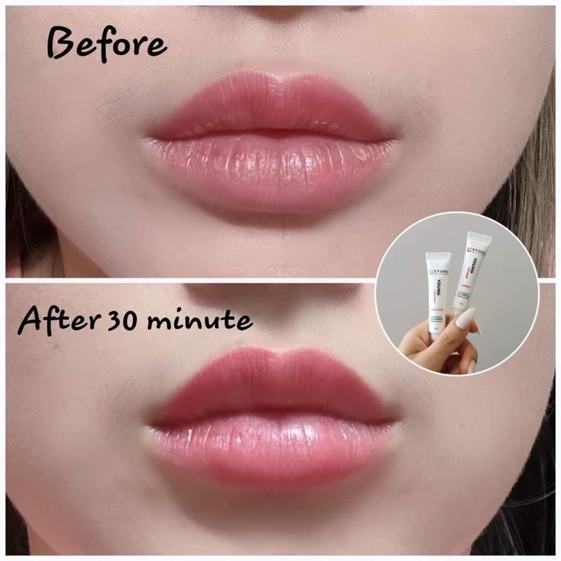 Son Dưỡng Môi Cấp Ẩm Kyung Lab Young Lip Cream Tuýp 10g