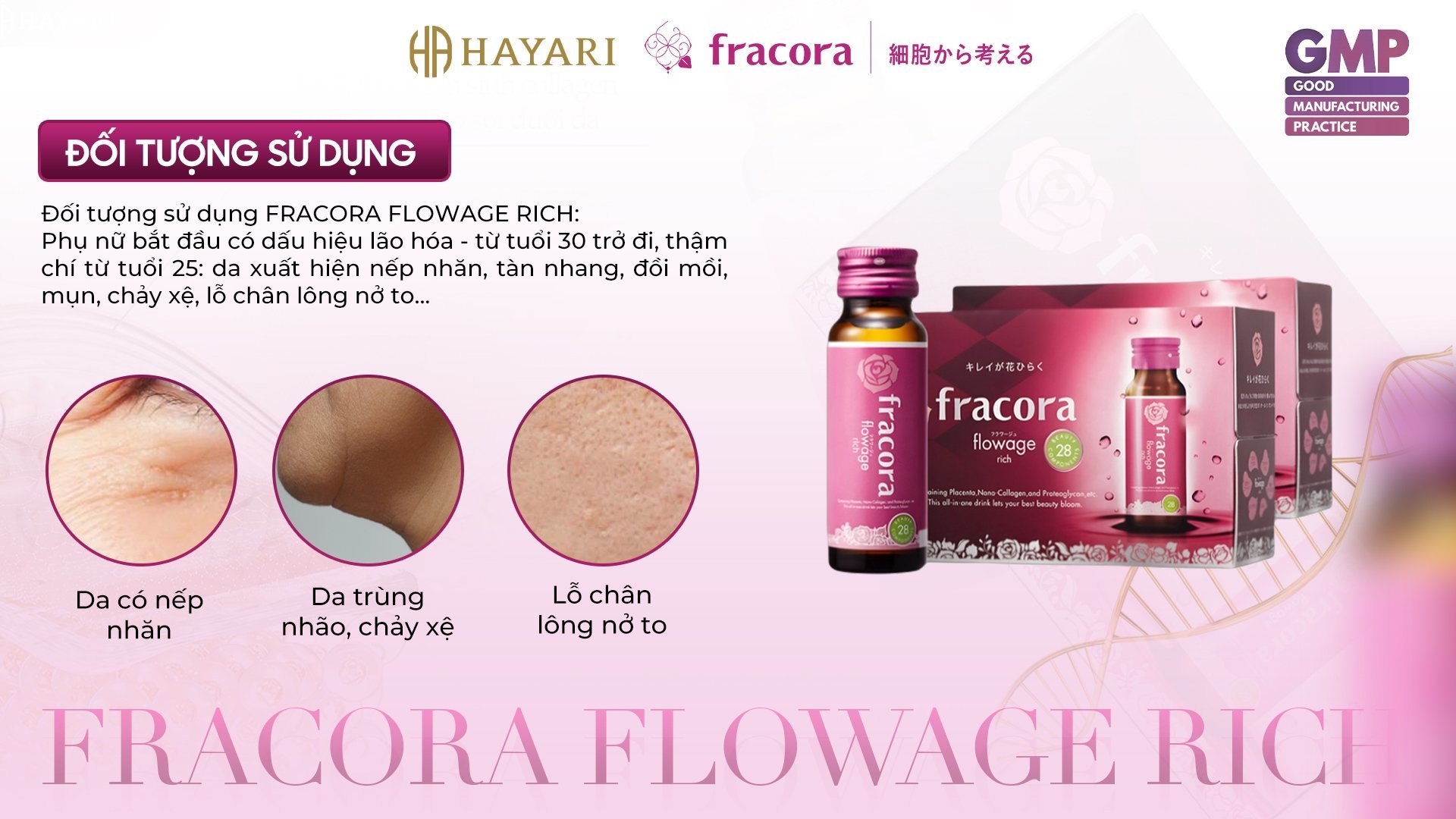 Nước Uống Nhau Thai Cừu Fracora Placenta