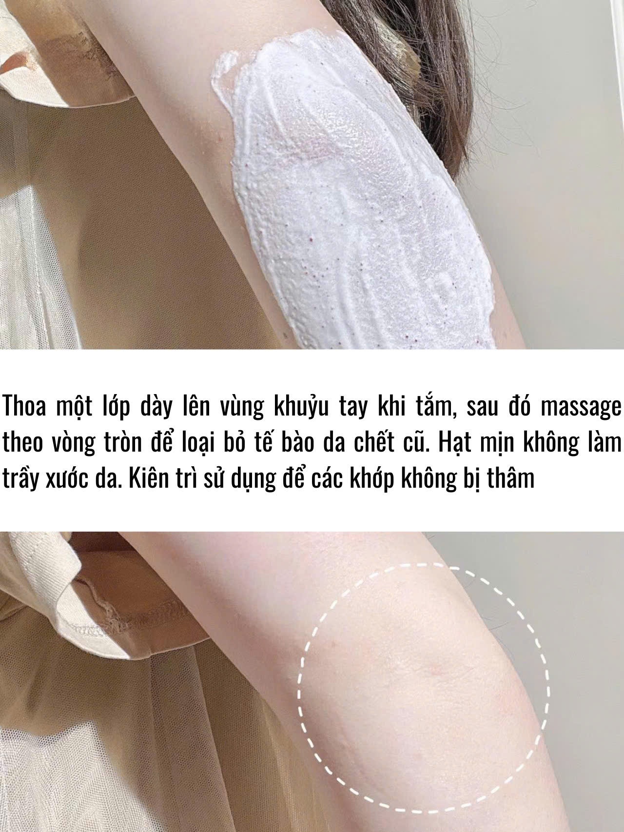 TẨY DA CHẾT ROSEMIDE