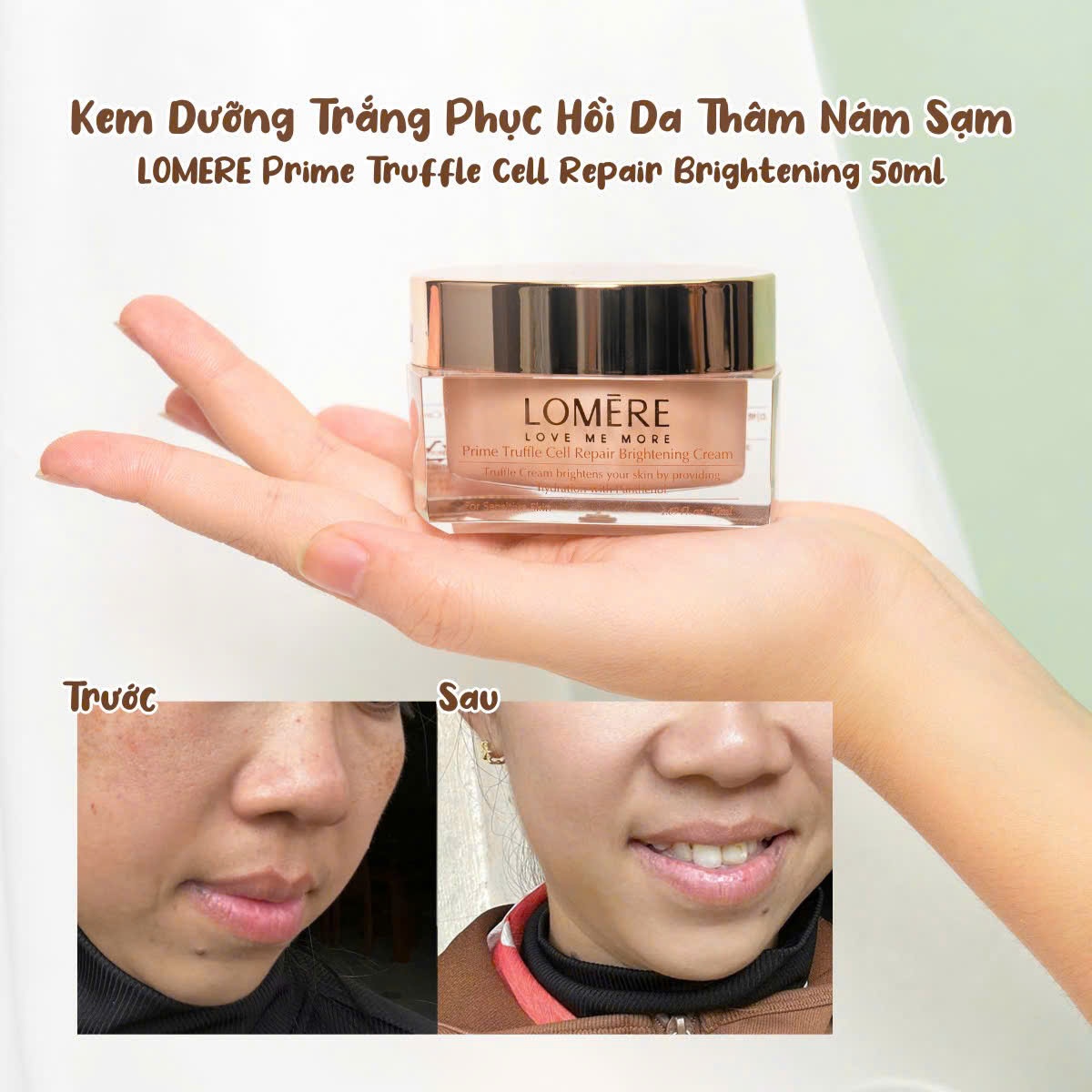 Kem Dưỡng Trắng Da Phục Hồi Lomere