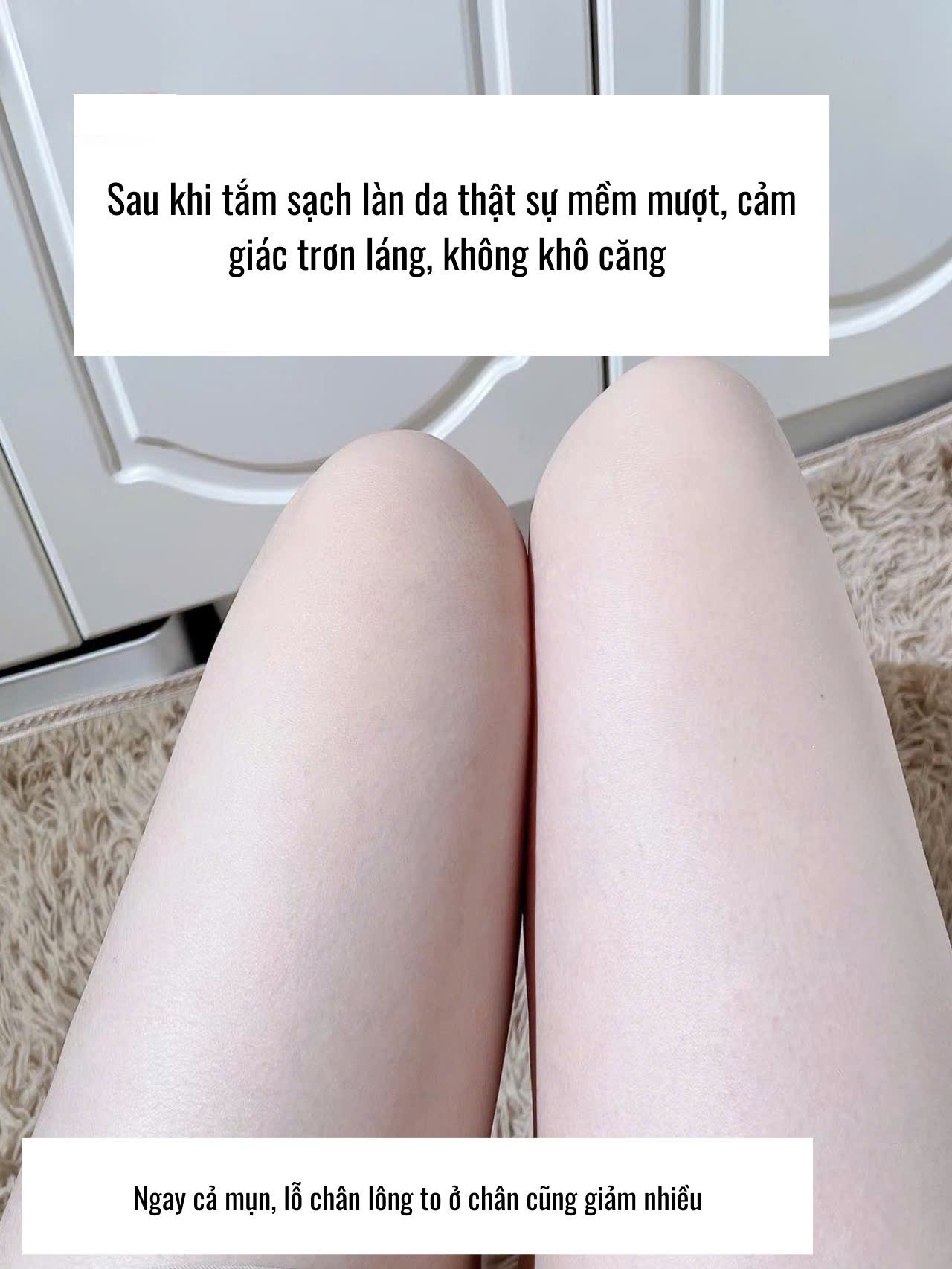 TẨY DA CHẾT ROSEMIDE
