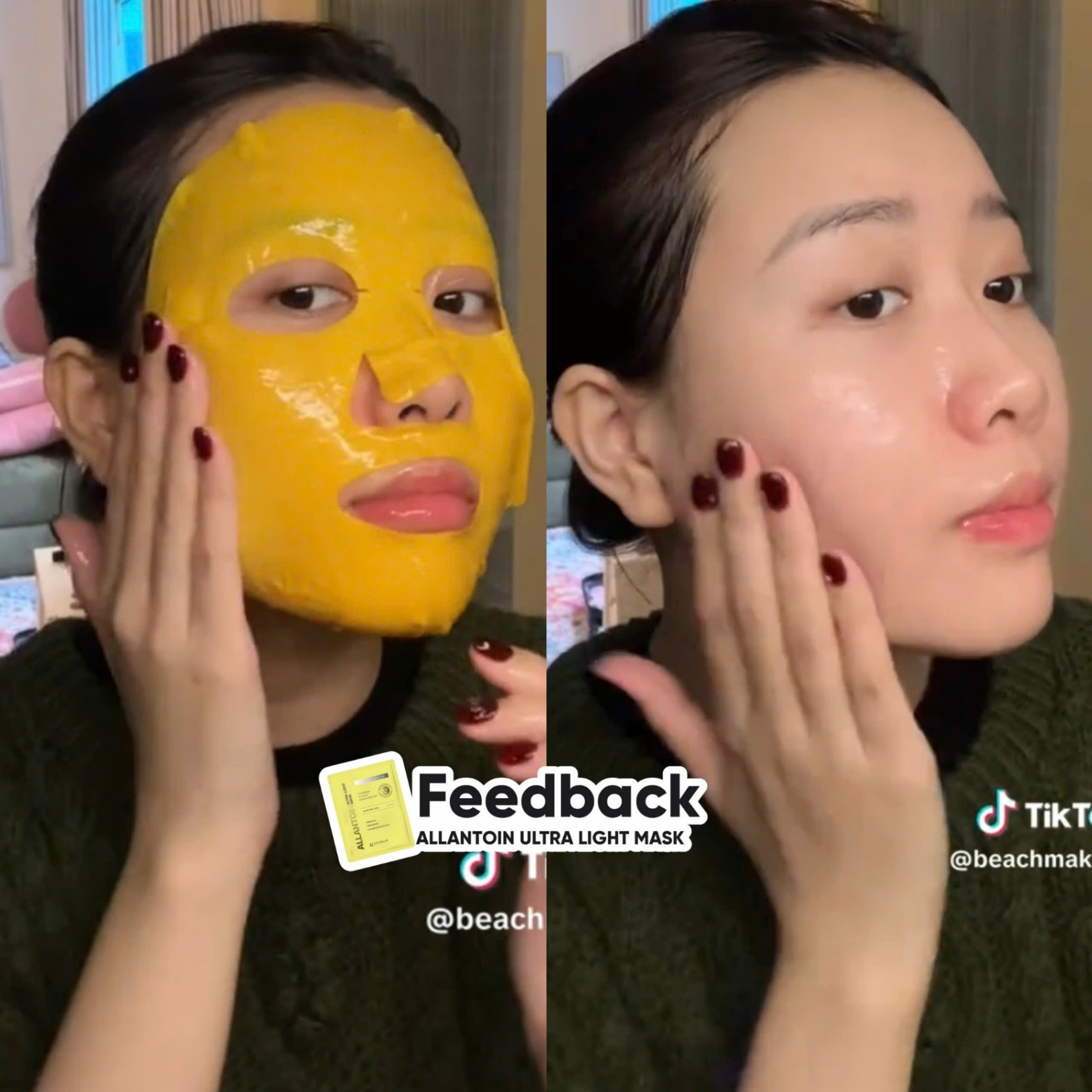 Mặt nạ Kyung Lab Ultra - Light Mask ALLANTOIN ULTRA-LIGHT MASK dưỡng trắng, cấp ẩm da - hộp 5 miếng