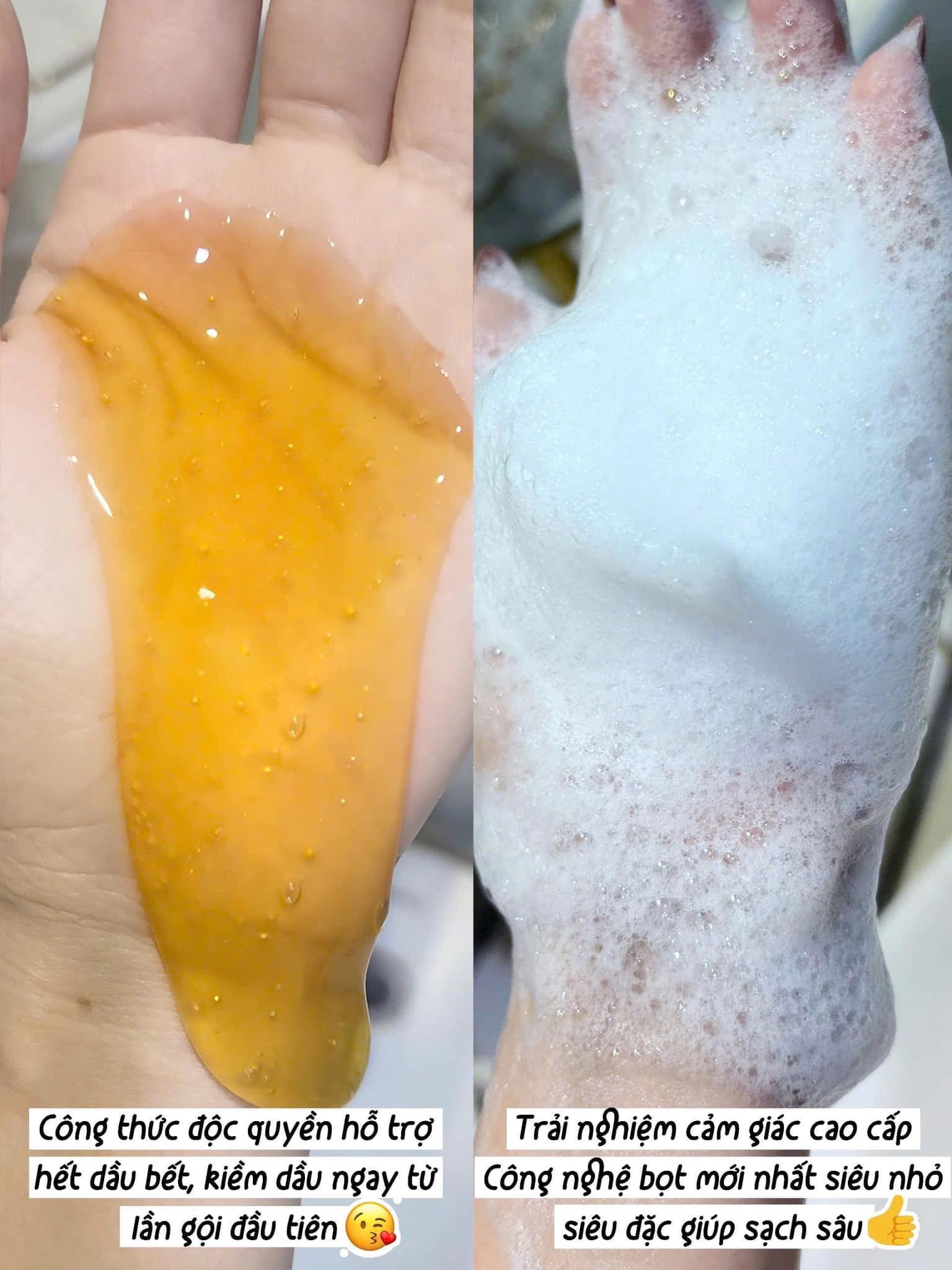 Cặp gội xả gừng Weilaiya Luxury kích mọc tóc dành cho tóc dầu