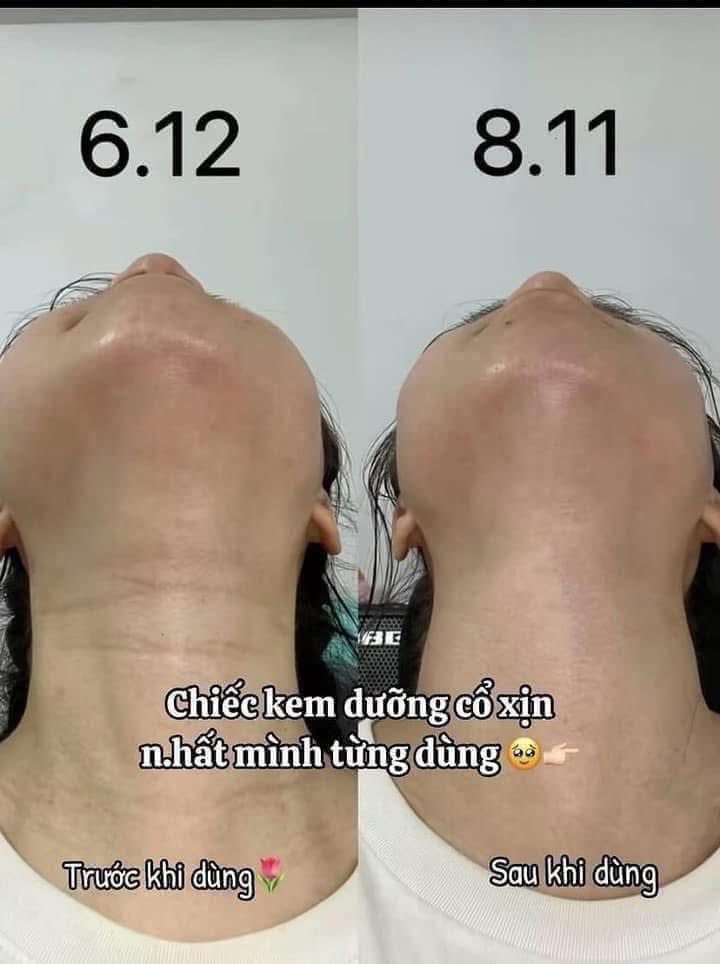 Kem Dưỡng Chống Lão Hóa Vùng Da Cổ Vella Ultimate Age Killer Neck Cream 50ml