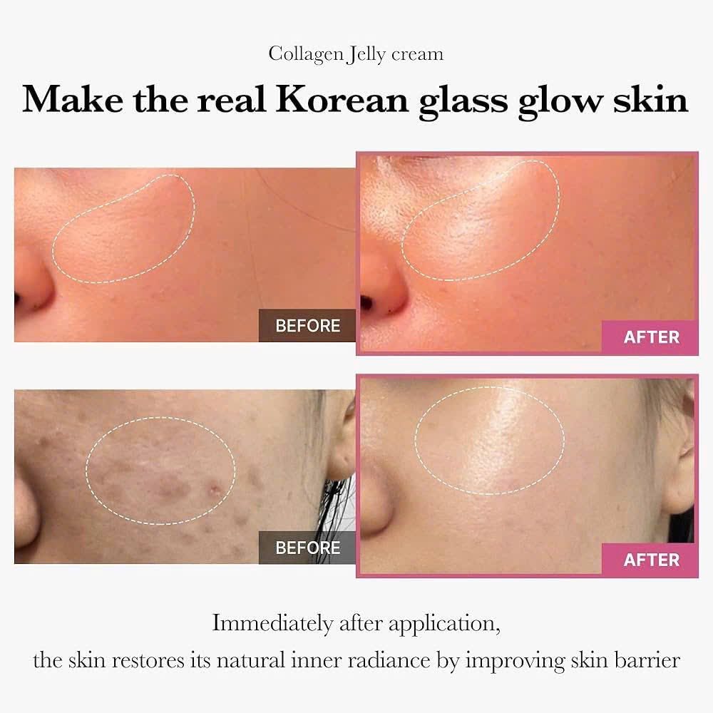 Kem Dưỡng Collagen Jelly Cream Medicube 110ml