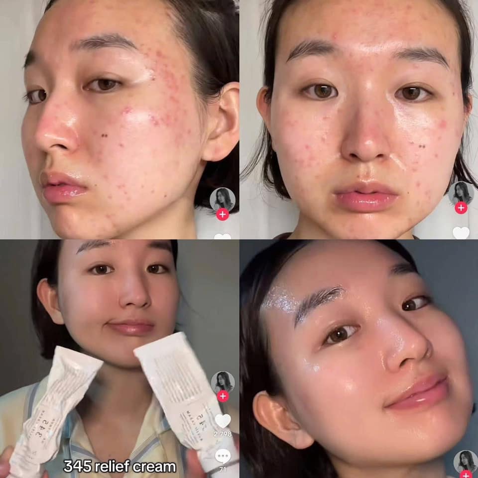 Kem dưỡng ẩm, phục hồi da Dr.Althea 345 Relief Cream 50ml