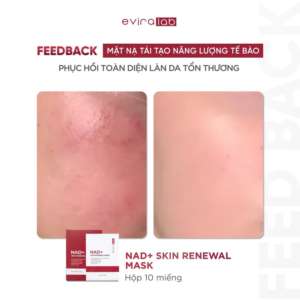 Mặt nạ Eviralab NAD+ Skin Renewal Mask (hộp 10 miếng)
