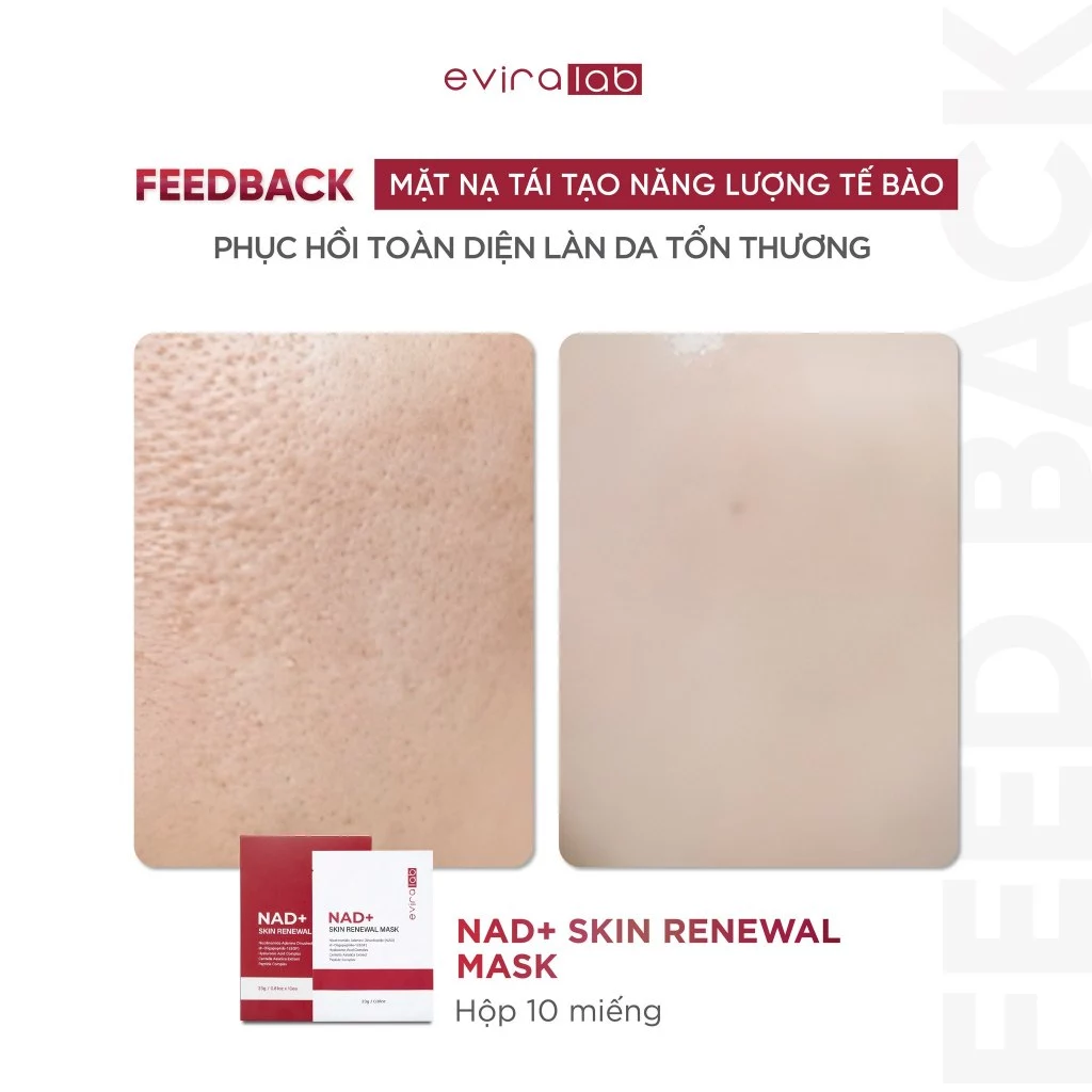 Mặt nạ Eviralab NAD+ Skin Renewal Mask (hộp 10 miếng)