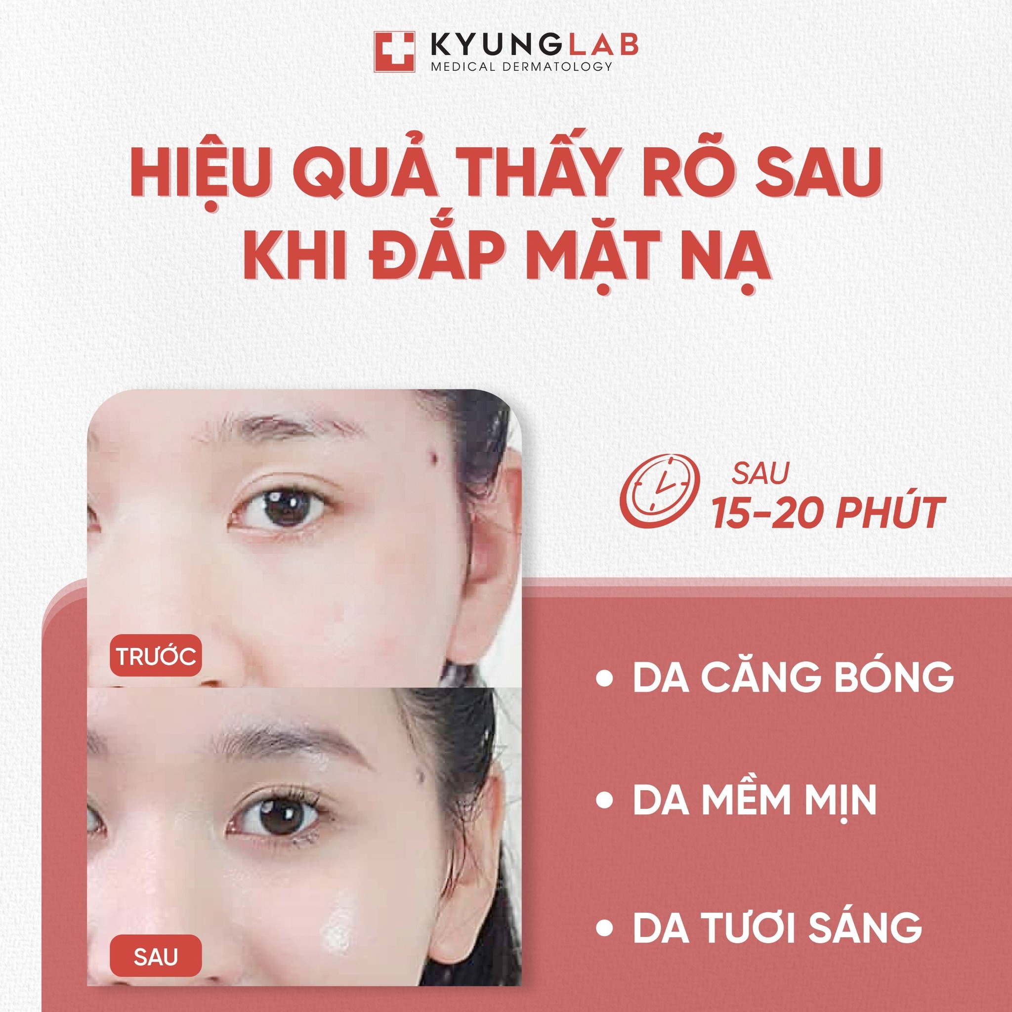 Mặt nạ Kyung Lab PDRN Therapy Mask (combo 10 miếng)