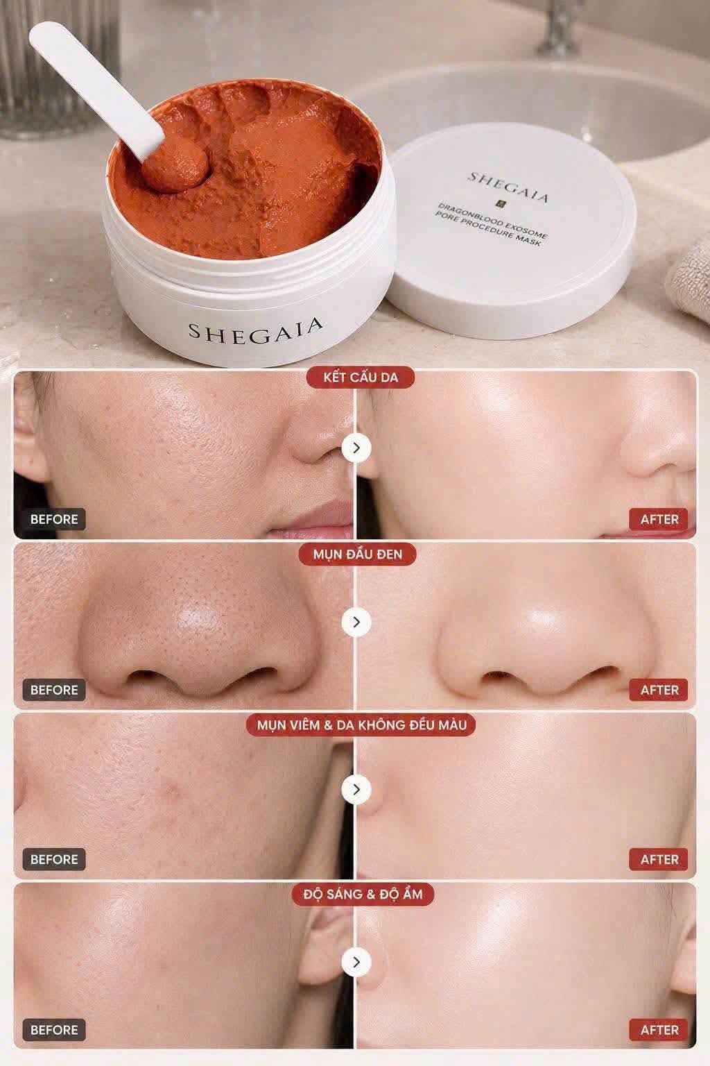 Mặt Nạ Đất Sét Huyết Rồng Shegaia – Thu Nhỏ Lỗ Chân Lông Hàn Quốc hộp 150g