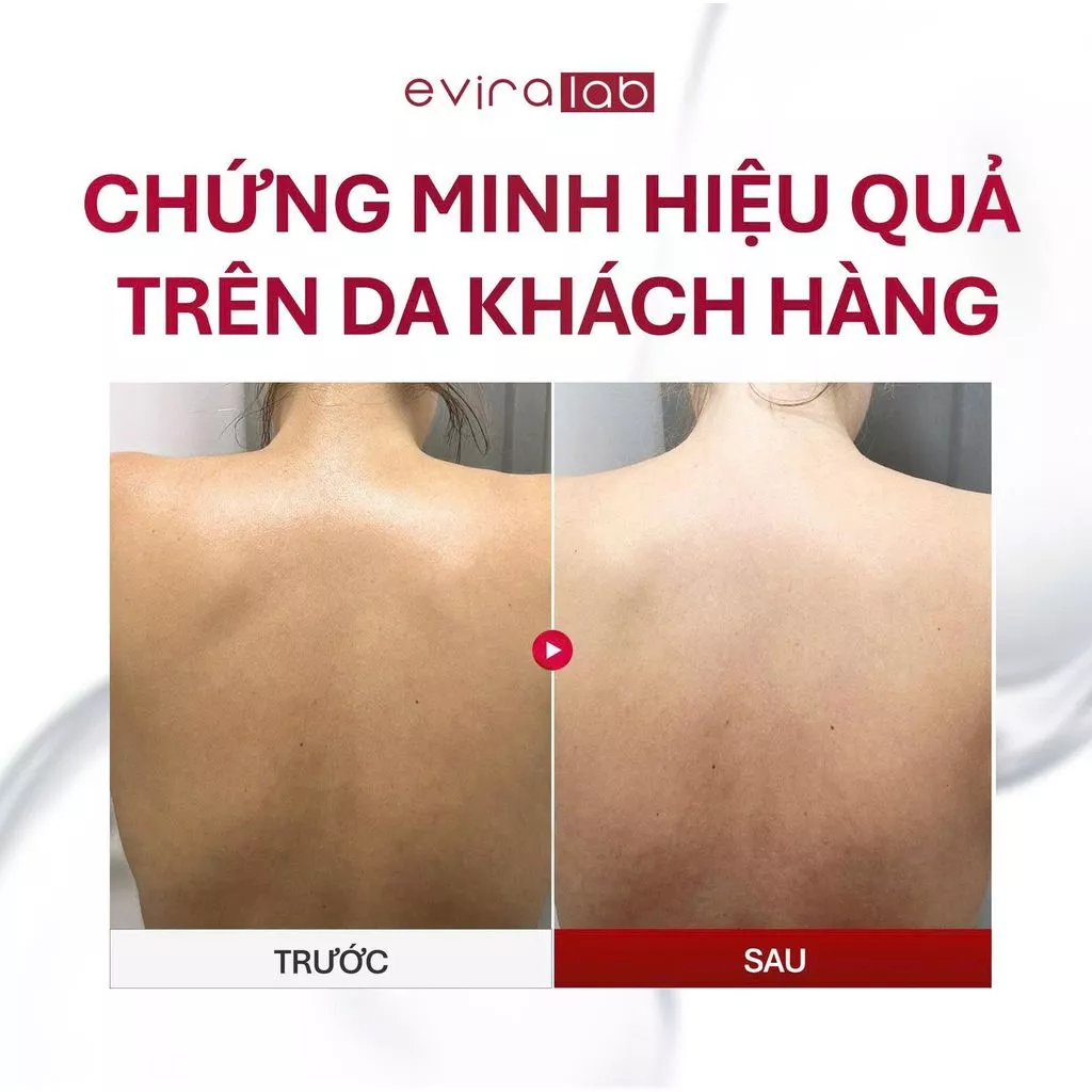 Sữa Tắm Trắng Da Eviralab Whitening Body cải thiện sắc da giúp làn da sạch mịn 300ml