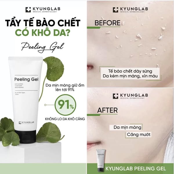 Tẩy Tế Bào Chết KyungLab Peeling Gel (Tuýp 150ml)