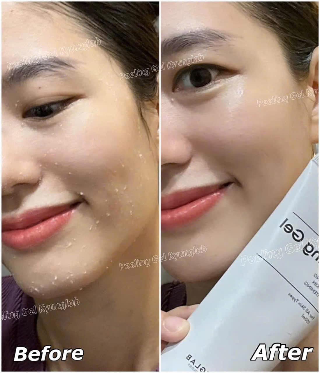 Tẩy Tế Bào Chết KyungLab Peeling Gel (Tuýp 150ml)