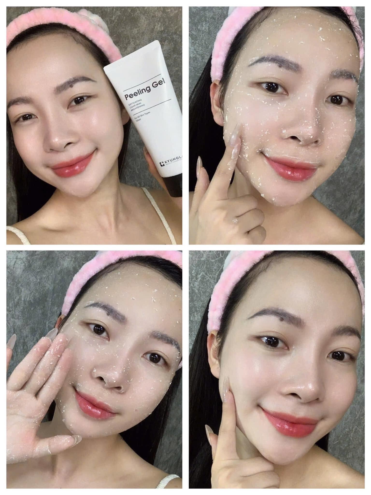 Tẩy Tế Bào Chết KyungLab Peeling Gel (Tuýp 150ml)