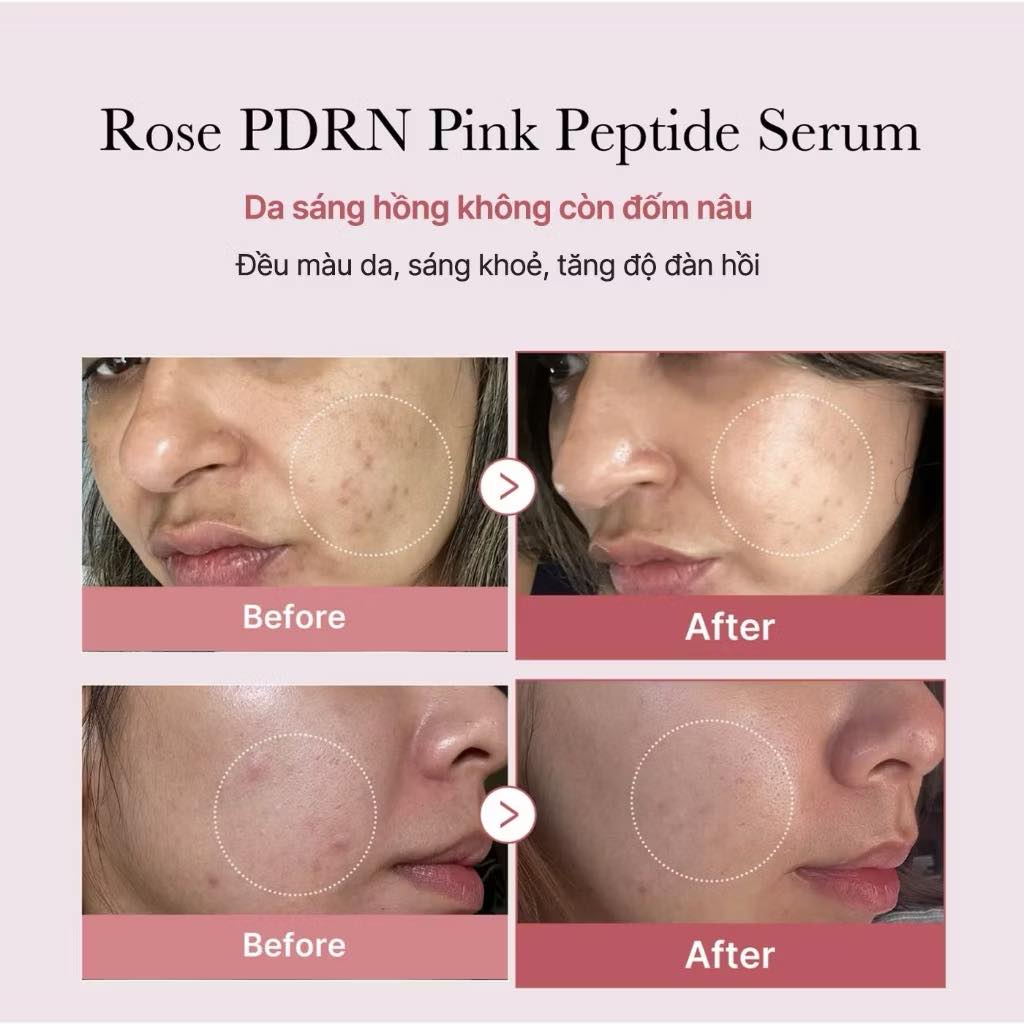 Tinh chất Medicube PDRN Pink Peptide Serum 30ml