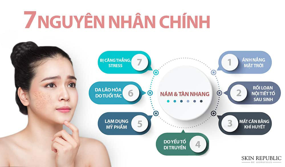 7 nguyên nhân gây nám và tan nhang trên da mặt