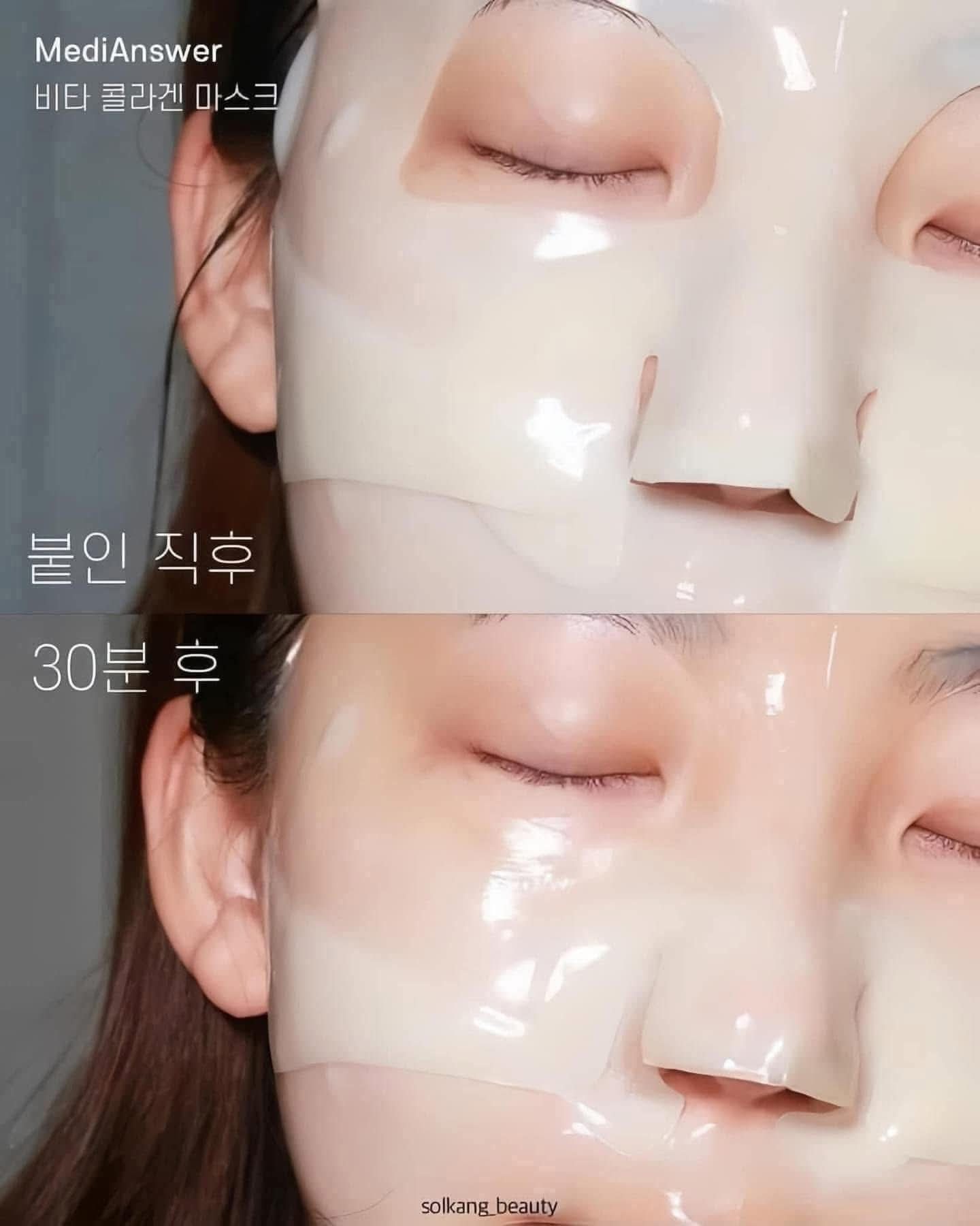 Mat-Na-Thach-Medianswer-Collagen-Mask-Duong-Da-Mem-Min-37g-Hop-5-mieng_513810609_4235628120004923_8633157143824366294_n.jpg