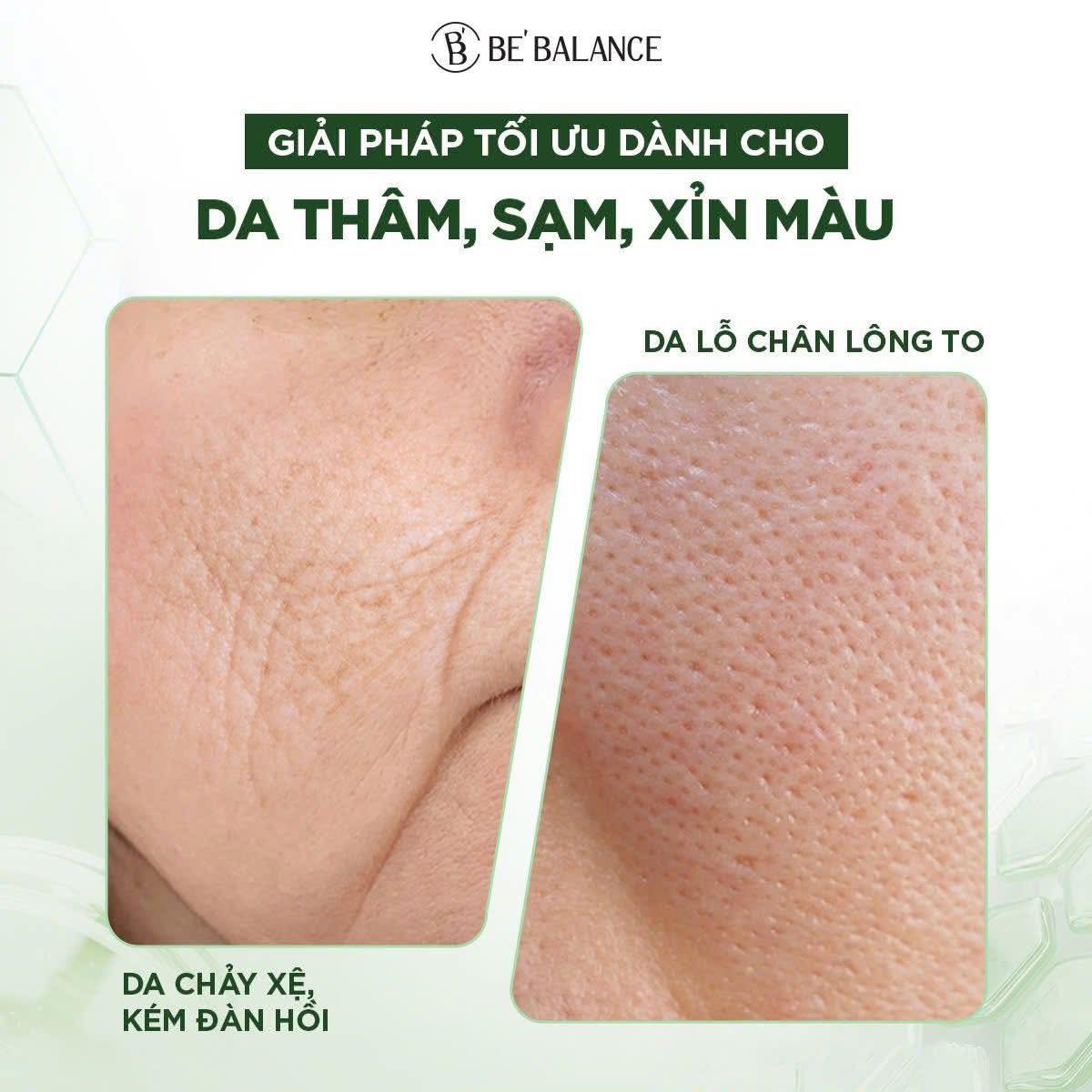 Mat-na-vai-vi-soi-NMM-ngai-cuu-SSUK-Micro-Fiber-Mask-1-hop-10-cai-_524283118_1334088752055109_2480510442282940575_n.jpg