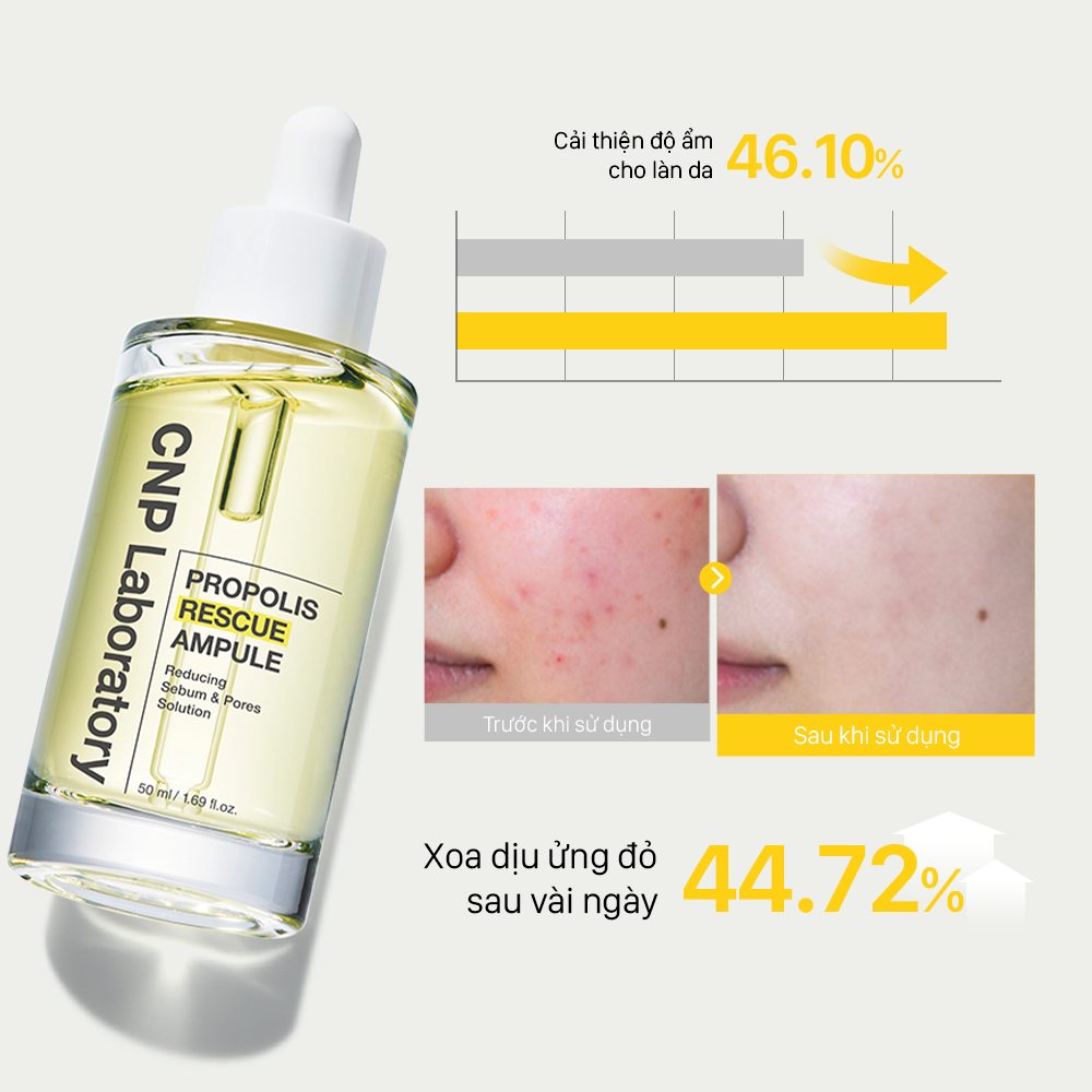 Tinh-chat-keo-ong-danh-cho-da-dau-mun-CNP-PROPOLIS-RESCUE-AMPULE-50ml-8.jpg?v=1774255199